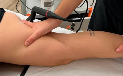 Fisioterapia para accidentes de tráfico en Elche