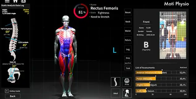 moti physio fisio